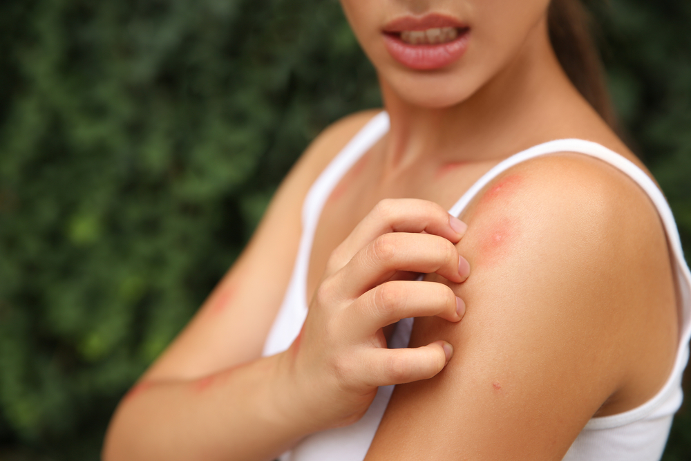 how to get rid of midges UK